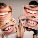 Hillbillies Bad Teeth, BVfasthealth