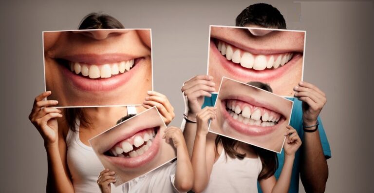 Hillbillies Bad Teeth, BVfasthealth
