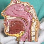 Balloon Sinuplasty
