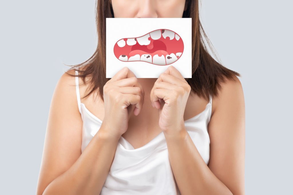 What Causes Cavities? : How to Prevent Tooth Decay?