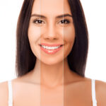 How To Improve Collagen Levels For Clearer Skin