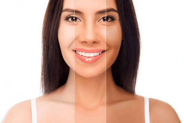 How To Improve Collagen Levels For Clearer Skin? How To Improve Collagen Levels For Clearer Skin