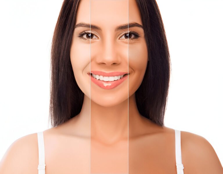 How To Improve Collagen Levels For Clearer Skin